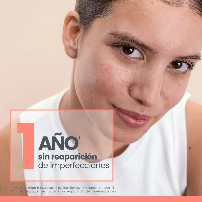 Avène Cleanance Comedomed Concentrado Anti-Imperfecciones, 30 ml - Image 4