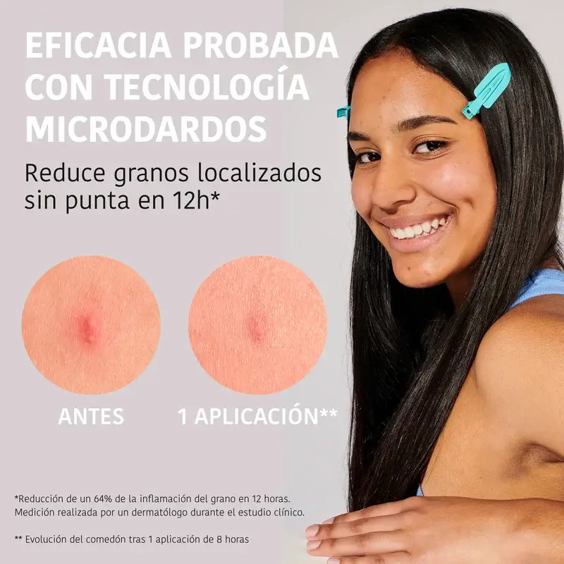 Iroha Nature Acne Prone Skin Parches Granos Microdardos, 12 unidades - Image 3